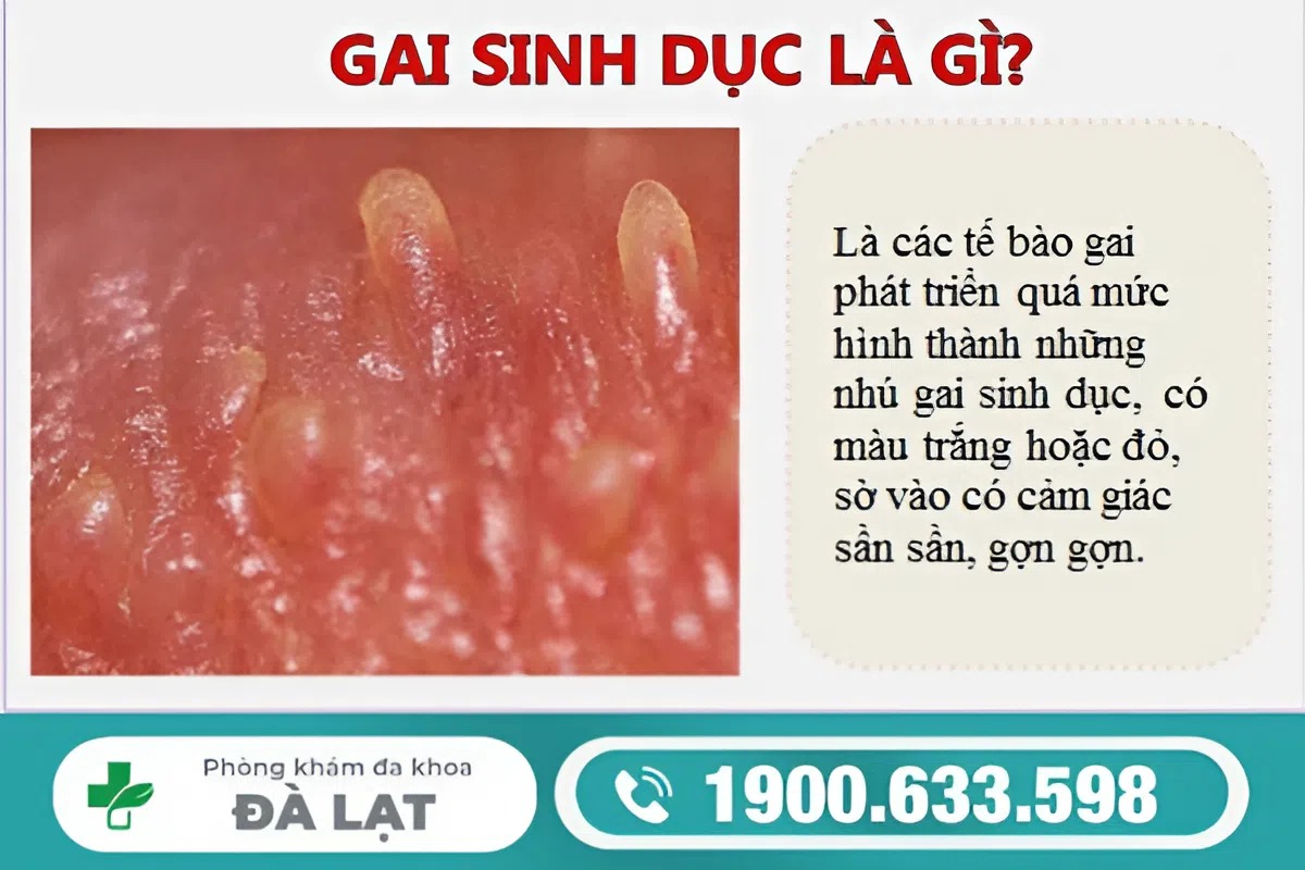 Hình ảnh minh họa